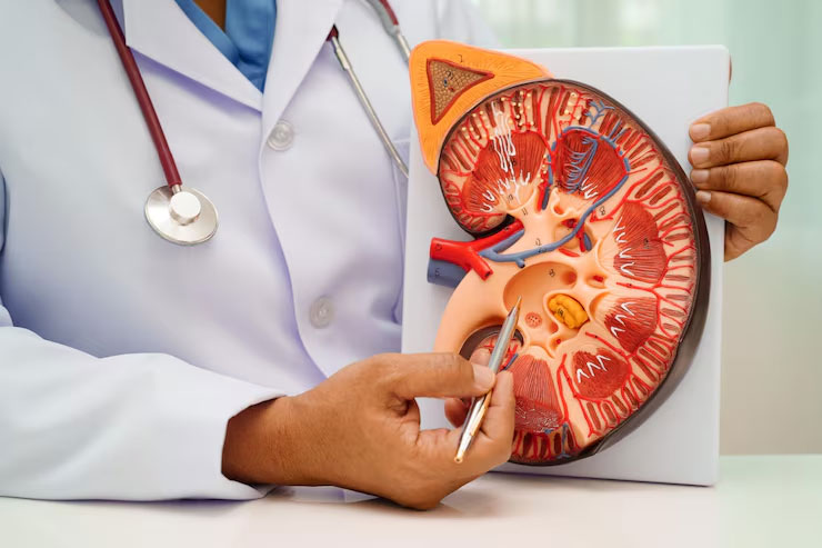 Homeopathy Treatment for Chronic Kidney Failure in Bangalore