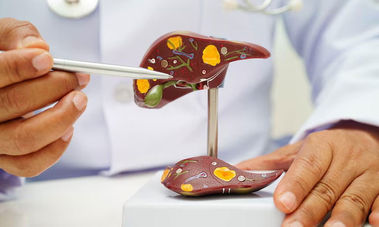 Homeopathy Treatment for Cirrhosis of Liver in Bangalore