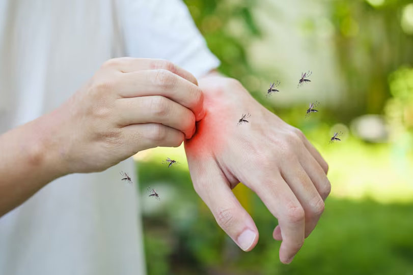 Homeopathy Treatment for Dengue in Bangalore 